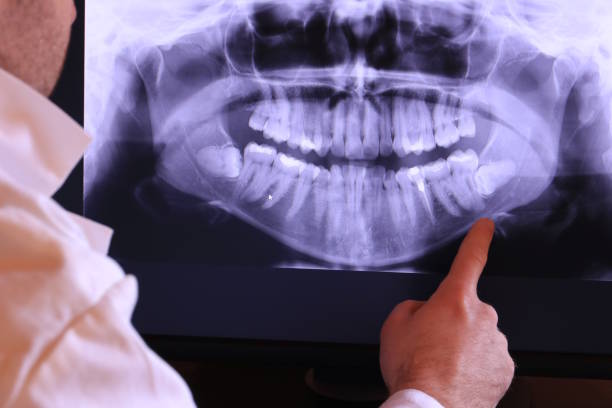Best Holiday Emergency Dentist in Huntington Woods, MI